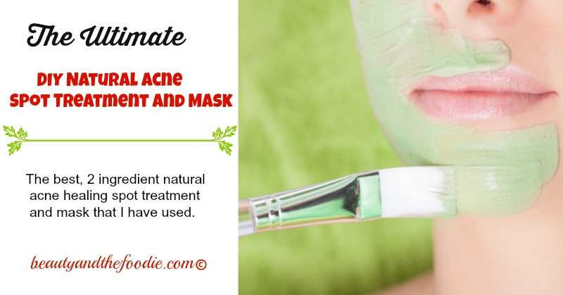Best ideas about DIY Acne Spot Treatment
. Save or Pin Ultimate Natural Acne Spot Treatment Now.