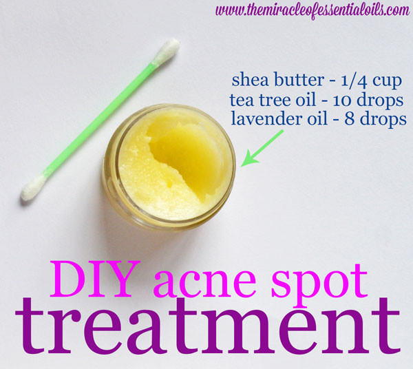 Best ideas about DIY Acne Spot Treatment
. Save or Pin DIY Essential Oil Acne Spot Treatment The Miracle of Now.