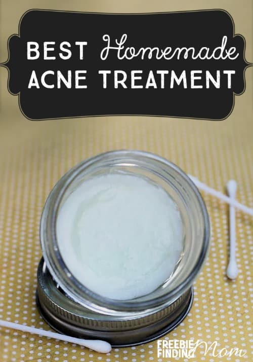 Best ideas about DIY Acne Spot Treatment
. Save or Pin Best Homemade Acne Treatment Now.