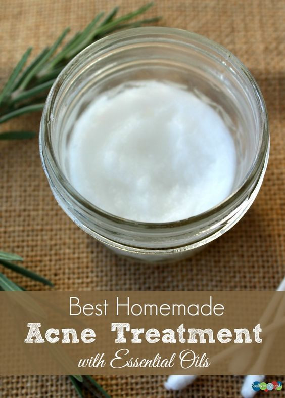 Best ideas about DIY Acne Treatment
. Save or Pin Pinterest • The world’s catalog of ideas Now.