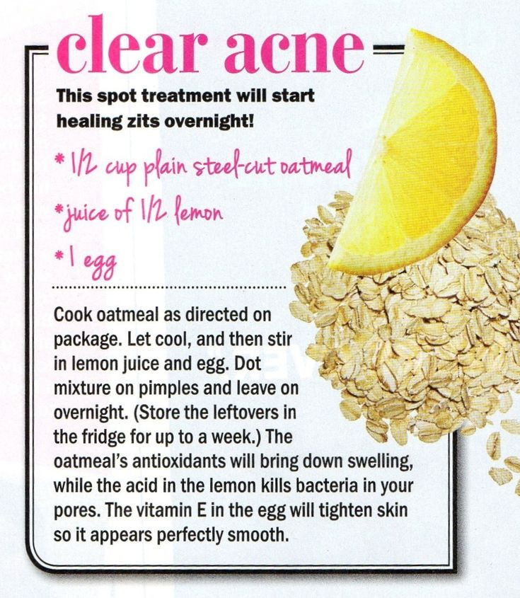 Best ideas about DIY Acne Treatment
. Save or Pin Clear acne with this DIY Spot Treatment straight out of Now.