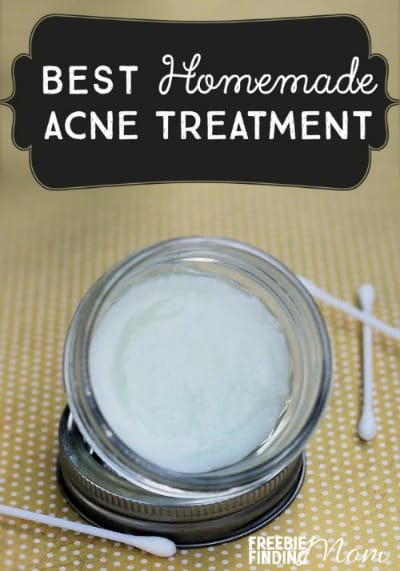 Best ideas about DIY Acne Treatment
. Save or Pin Making Homemade Beauty Products Is Easy These 14 DIY Now.