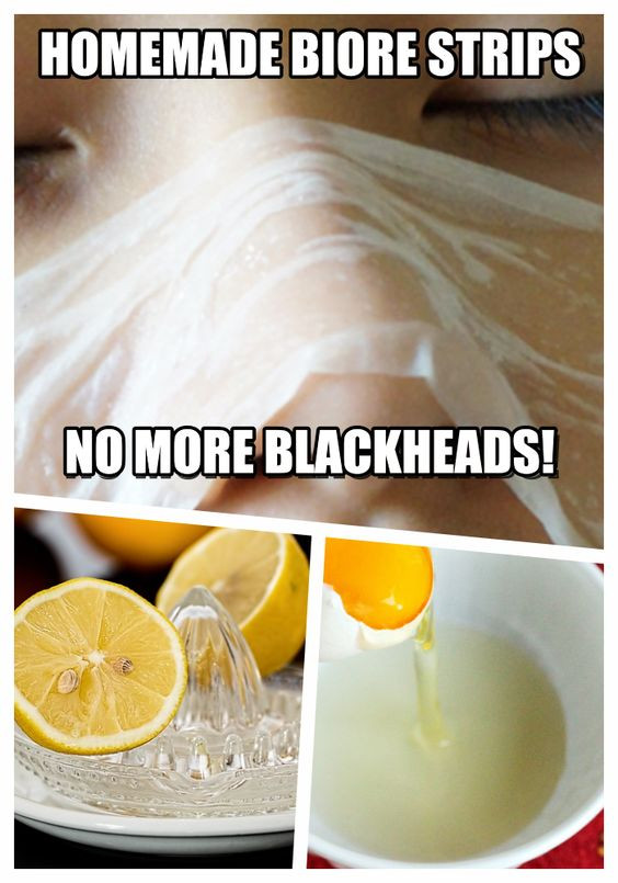 Best ideas about DIY Blackhead Strips
. Save or Pin Homemade Biore strips Now.