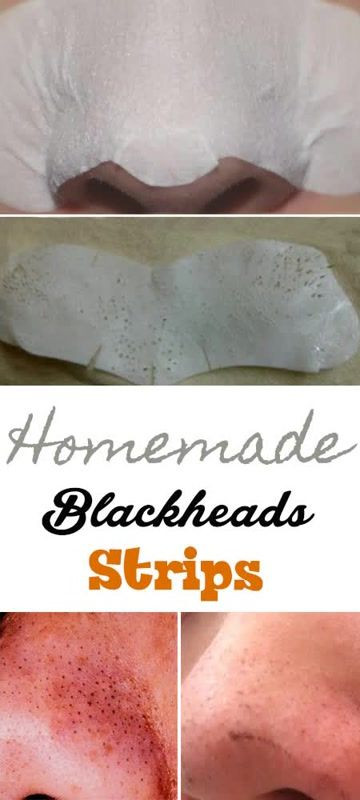 Best ideas about DIY Blackhead Strips
. Save or Pin 17 Best ideas about Nose Strips For Blackheads on Now.