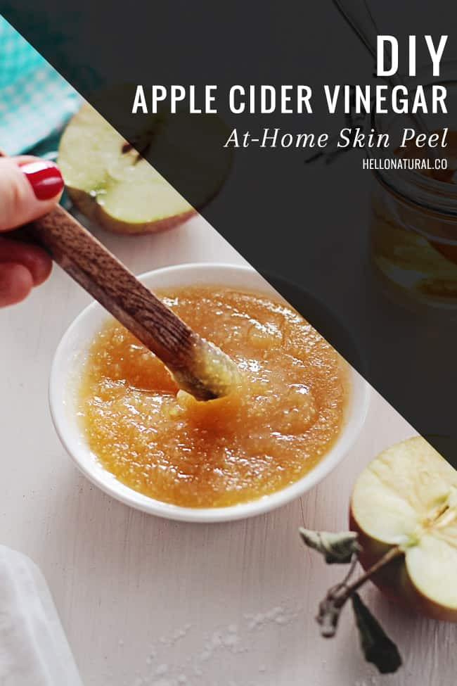 Best ideas about DIY Chemical Peels
. Save or Pin DIY Apple Cider Vinegar At Home Skin Peel Now.