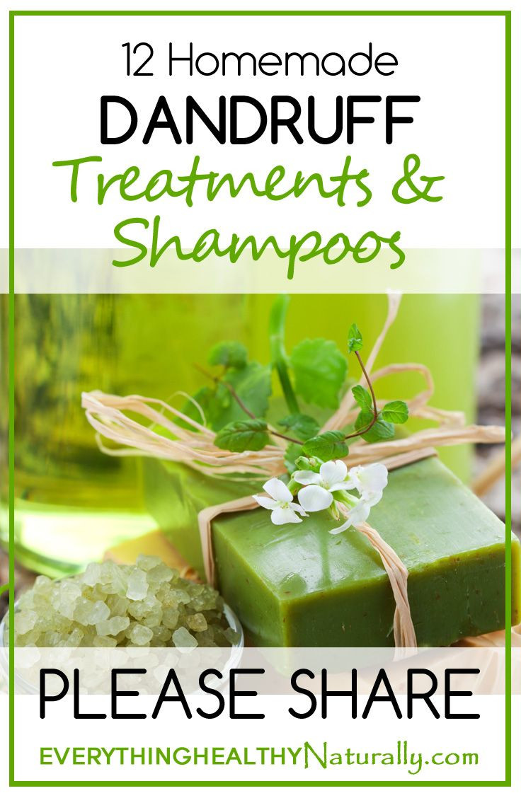 Best ideas about DIY Dandruff Shampoo
. Save or Pin 25 best ideas about Dandruff Treatment on Pinterest Now.