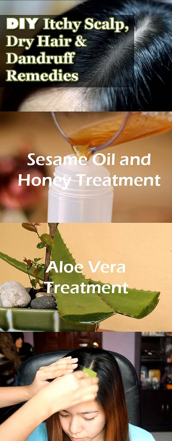 Best ideas about DIY Dry Scalp Treatment
. Save or Pin DIY Itchy Scalp Dry Hair & Dandruff Reme s Now.