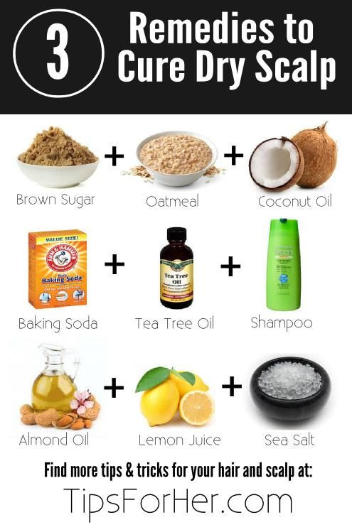 Best ideas about DIY Dry Scalp Treatment
. Save or Pin Best 25 Itchy scalp treatment ideas on Pinterest Now.