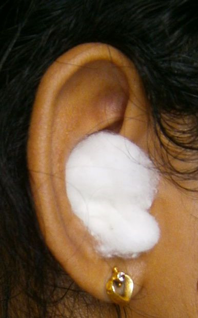 Best ideas about DIY Ear Plug
. Save or Pin DIY Quick Swimmers Ear Plug Now.