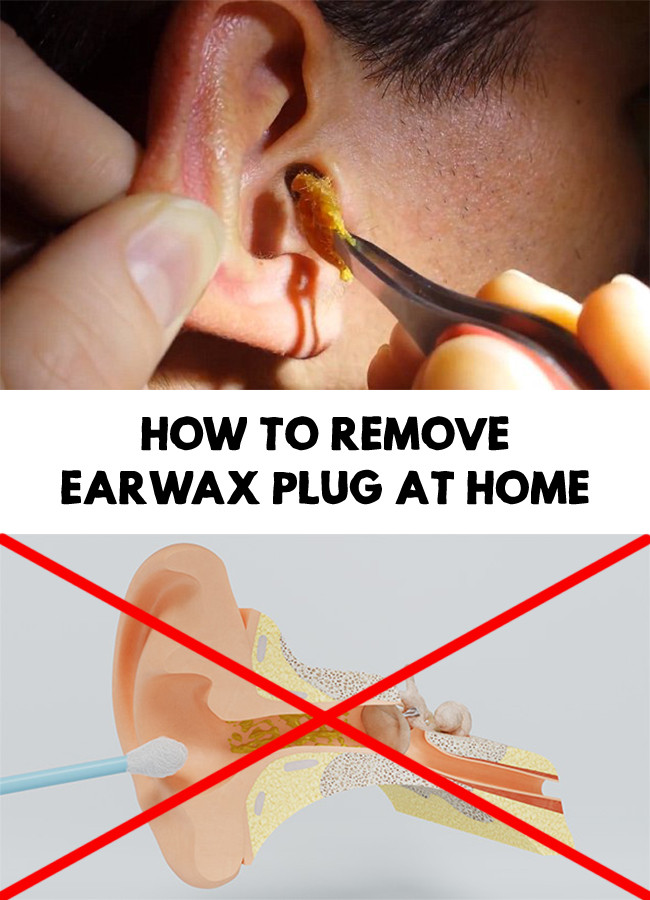 Best ideas about DIY Ear Wax Removal
. Save or Pin How To Remove Earwax Plug At Home Now.