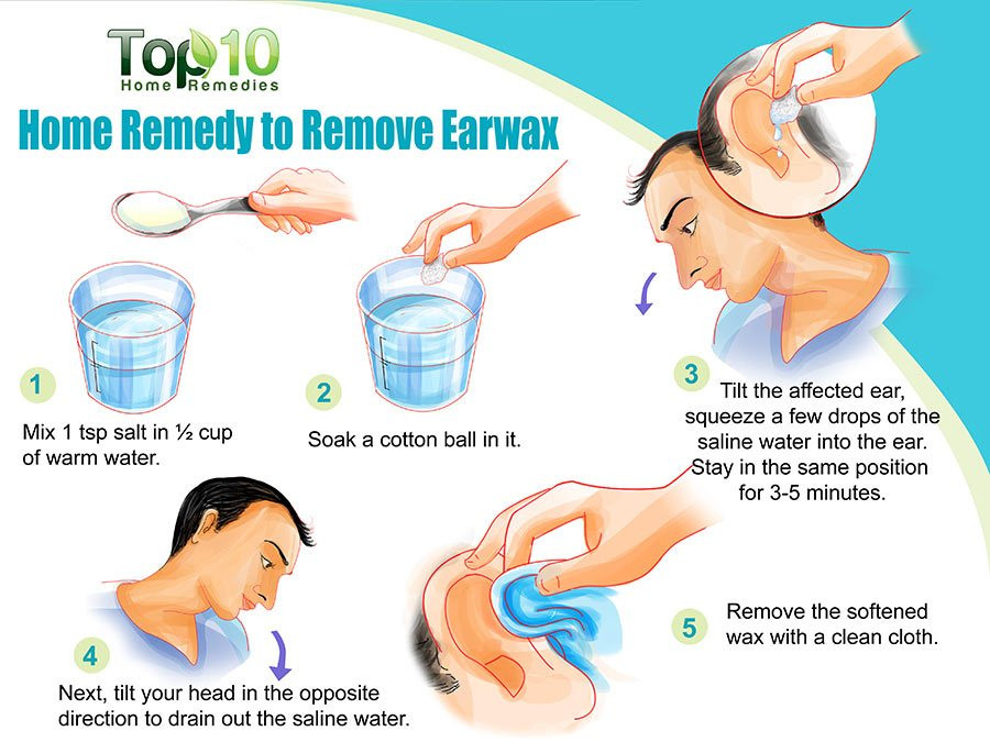 Best ideas about DIY Ear Wax Removal
. Save or Pin Home Reme s to Remove Earwax Now.