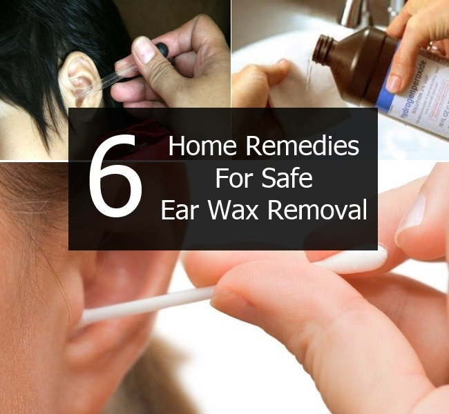 Best ideas about DIY Ear Wax Removal
. Save or Pin Treatment For Ear Ringing Now.