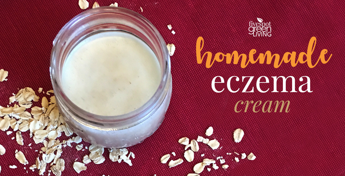 Best ideas about DIY Eczema Cream
. Save or Pin Homemade Eczema Cream Recipe for Dry Winter Skin Five Now.