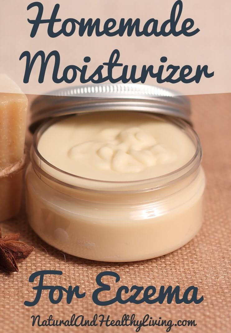 Best ideas about DIY Eczema Cream
. Save or Pin Homemade Eczema Cream All Natural Lotion Safe for kids Now.