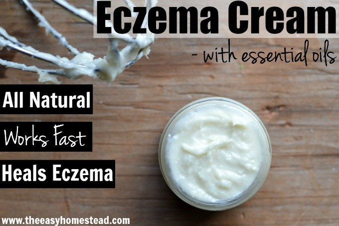 Best ideas about DIY Eczema Cream
. Save or Pin Homemade Eczema Cream with Essential Oils Now.