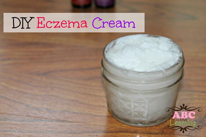 Best ideas about DIY Eczema Cream
. Save or Pin DIY Homemade Eczema Cream Now.