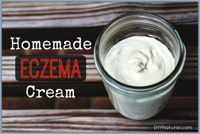 Best ideas about DIY Eczema Cream
. Save or Pin Natural Homemade Eczema Cream Your Skin Is Worth It Now.