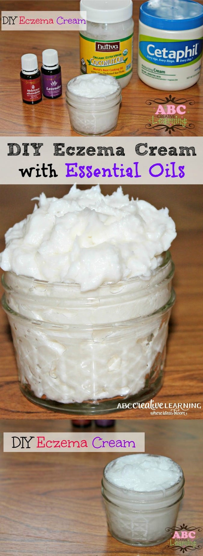 Best ideas about DIY Eczema Cream
. Save or Pin Best DIY Homemade Eczema Cream with Essential Oils Now.