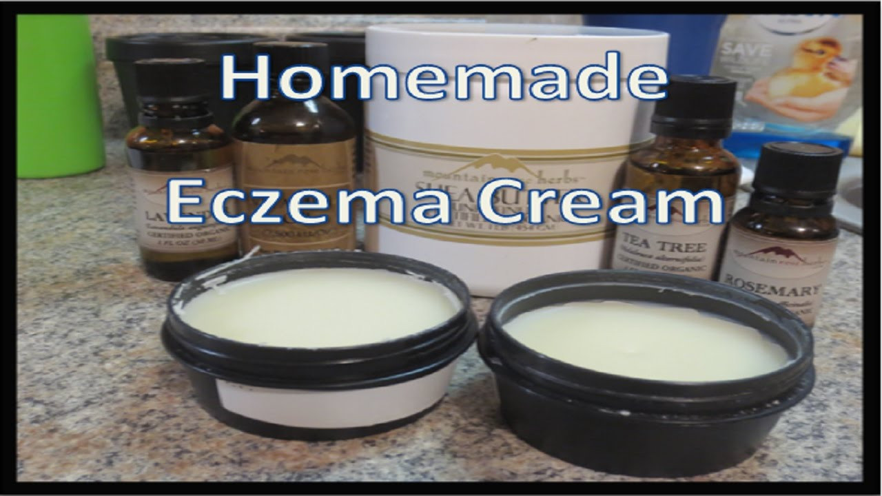 Best ideas about DIY Eczema Cream
. Save or Pin Homemade Eczema Cream Now.