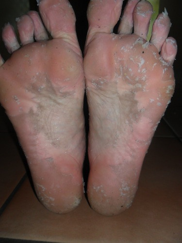Best ideas about DIY Foot Peel
. Save or Pin Looking for Pigmentation dead skin on feet Now.