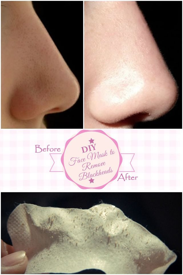 Best ideas about DIY Nose Strip
. Save or Pin Best 25 Homemade pore strips ideas on Pinterest Now.