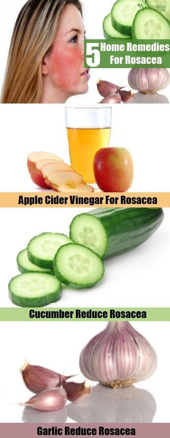 Best ideas about DIY Rosacea Treatment
. Save or Pin Top 5 Home Reme s For Rosacea cuidados Now.