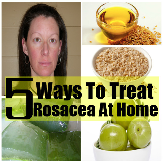 Best ideas about DIY Rosacea Treatment
. Save or Pin 5 Effective Ways To Treat Rosacea At Home Now.