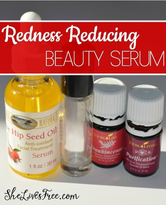 Best ideas about DIY Rosacea Treatment
. Save or Pin 17 Best images about DIY Rosacea Natural Reme s on Now.