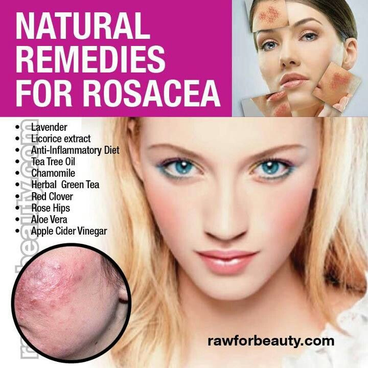 Best ideas about DIY Rosacea Treatment
. Save or Pin Best 25 Rosacea reme s ideas on Pinterest Now.