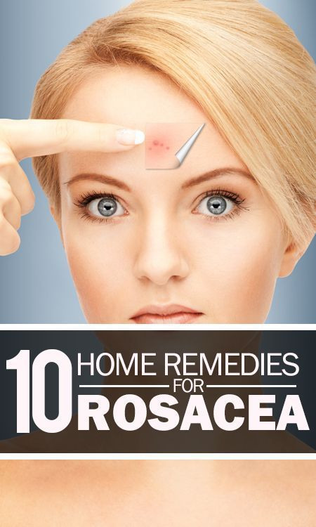 Best ideas about DIY Rosacea Treatment
. Save or Pin 25 great ideas about Rosacea treatment on Pinterest Now.