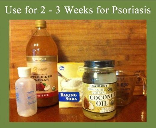 Best ideas about DIY Scalp Treatment
. Save or Pin Homemade Natural Psoriasis Shampoo Now.