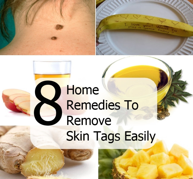 Best ideas about DIY Skin Tag Removal
. Save or Pin 8 Effective And Useful Home Reme s To Remove Skin Tags Now.