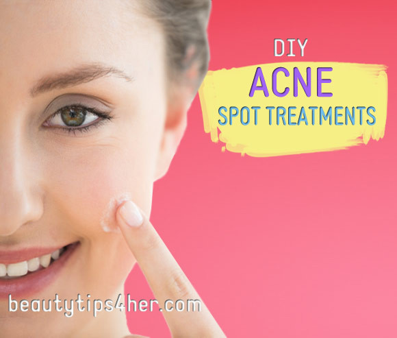 Best ideas about DIY Spot Treatment
. Save or Pin DIY Acne Spot Treatments How To Zap Zits Faster Now.