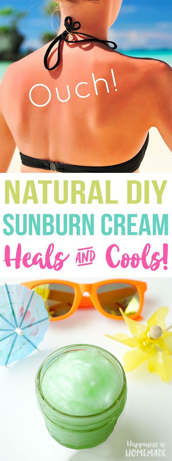 Best ideas about DIY Sunburn Relief
. Save or Pin DIY Natural Sunburn Relief Cream Now.