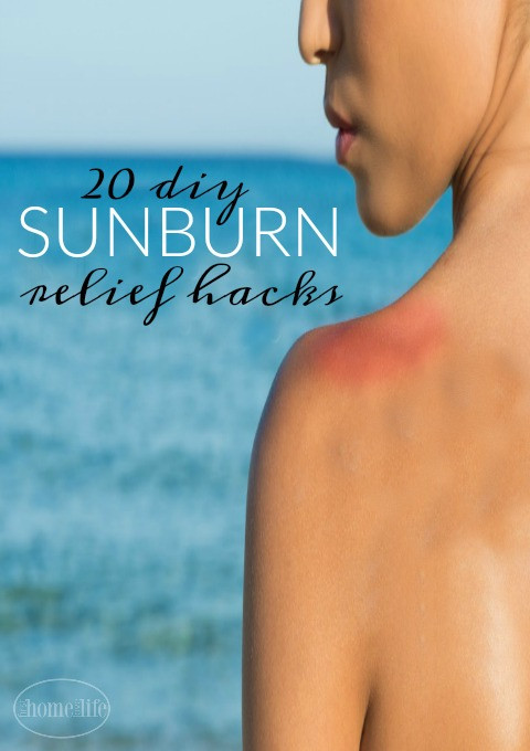 Best ideas about DIY Sunburn Relief
. Save or Pin 20 DIY Sunburn Relief Hacks First Home Love Life Now.