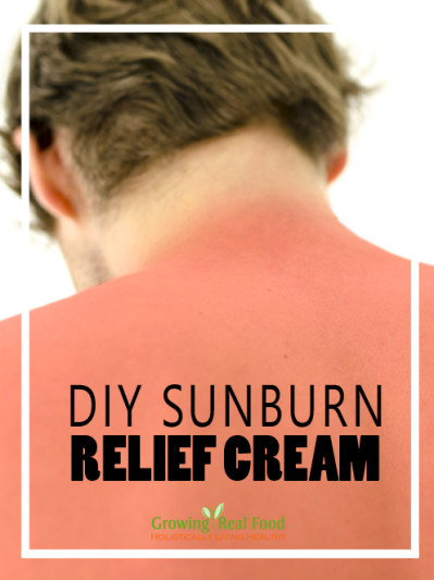 Best ideas about DIY Sunburn Relief
. Save or Pin DIY Sunburn Relief Cream Now.