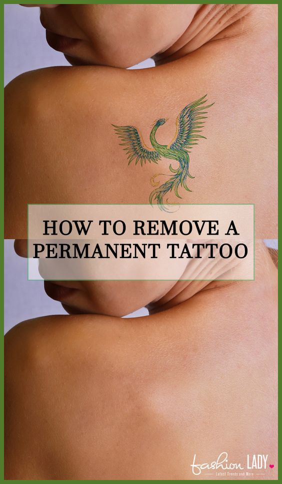 Best ideas about DIY Tatoo Removal
. Save or Pin How To Remove A Permanent Tattoo DIY Methods and Surgical Now.