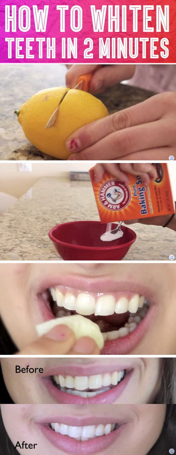 Best ideas about DIY Teeth Whitening
. Save or Pin Best 25 Homemade teeth whitening ideas on Pinterest Now.