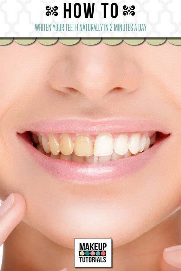 Best ideas about DIY Teeth Whitening
. Save or Pin DIY Teeth Whitening Now.