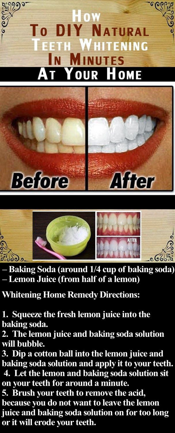 Best ideas about DIY Teeth Whitening
. Save or Pin DIY Natural Teeth Whitening In Minutes At Your Home Now.