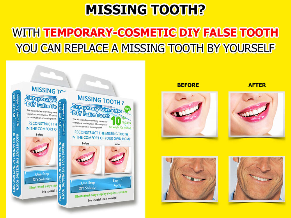 Best ideas about DIY Tooth Filling
. Save or Pin 2x Temporary Missing Tooth Repair Kit TEETH REPLACEMENT Now.