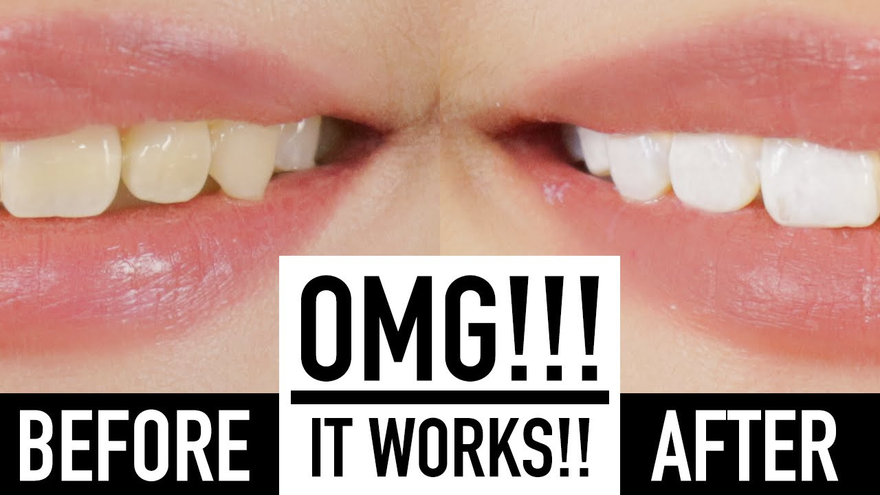 Best ideas about DIY Tooth Paint
. Save or Pin Whiten Teeth Instantly With MAKEUP ♥ Wengie Now.