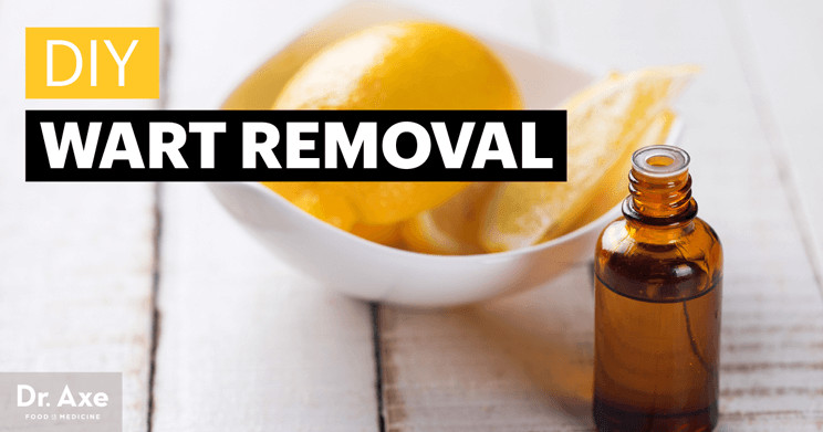 Best ideas about DIY Wart Removal
. Save or Pin DIY Wart Remover Wart Removal with Frankincense & Lemon Now.