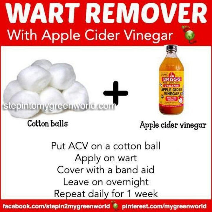 Best ideas about DIY Wart Removal
. Save or Pin Wart removal DIY Now.
