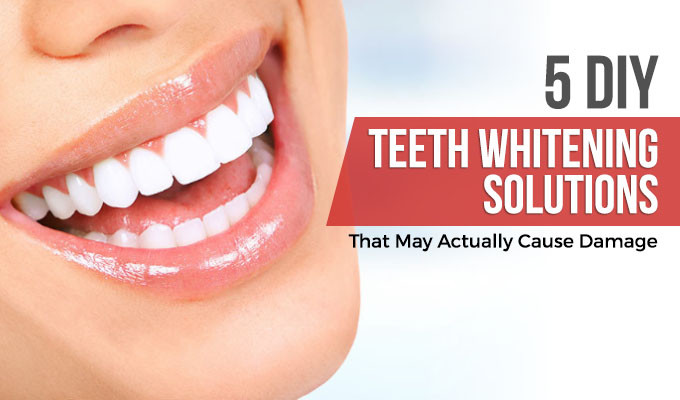 Best ideas about DIY Whiter Teeth
. Save or Pin 5 DIY Teeth Whitening Solutions That May Actually Cause Now.