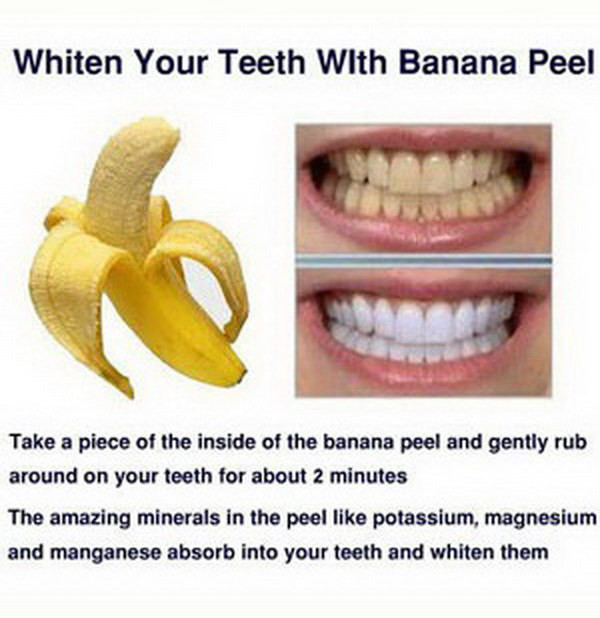 Best ideas about DIY Whiter Teeth
. Save or Pin 15 Natural Ways to Whiten Your Teeth Homemade Teeth Now.