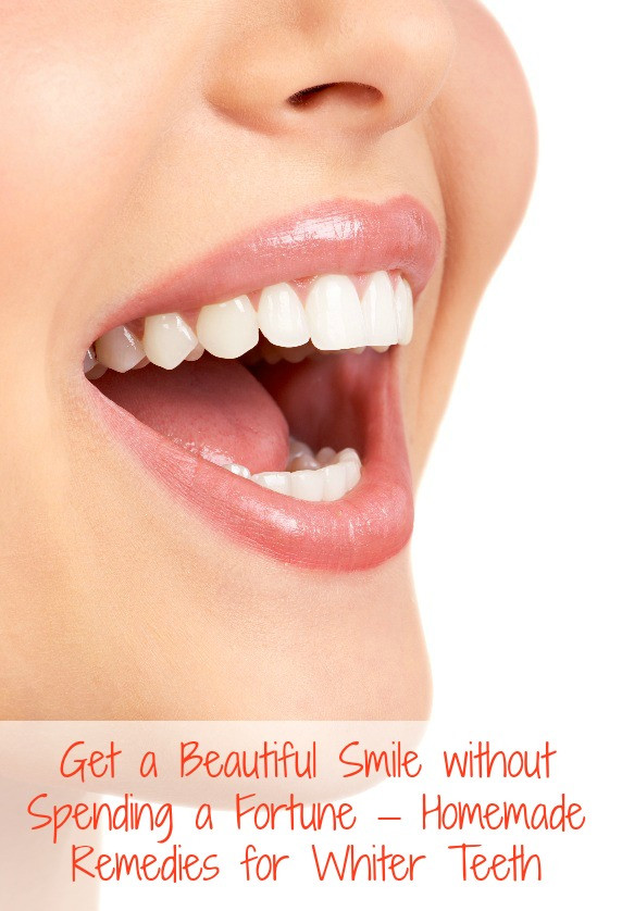 Best ideas about DIY Whiter Teeth
. Save or Pin DIY Teeth Whitening – 4 Proven Homemade Reme s for Now.