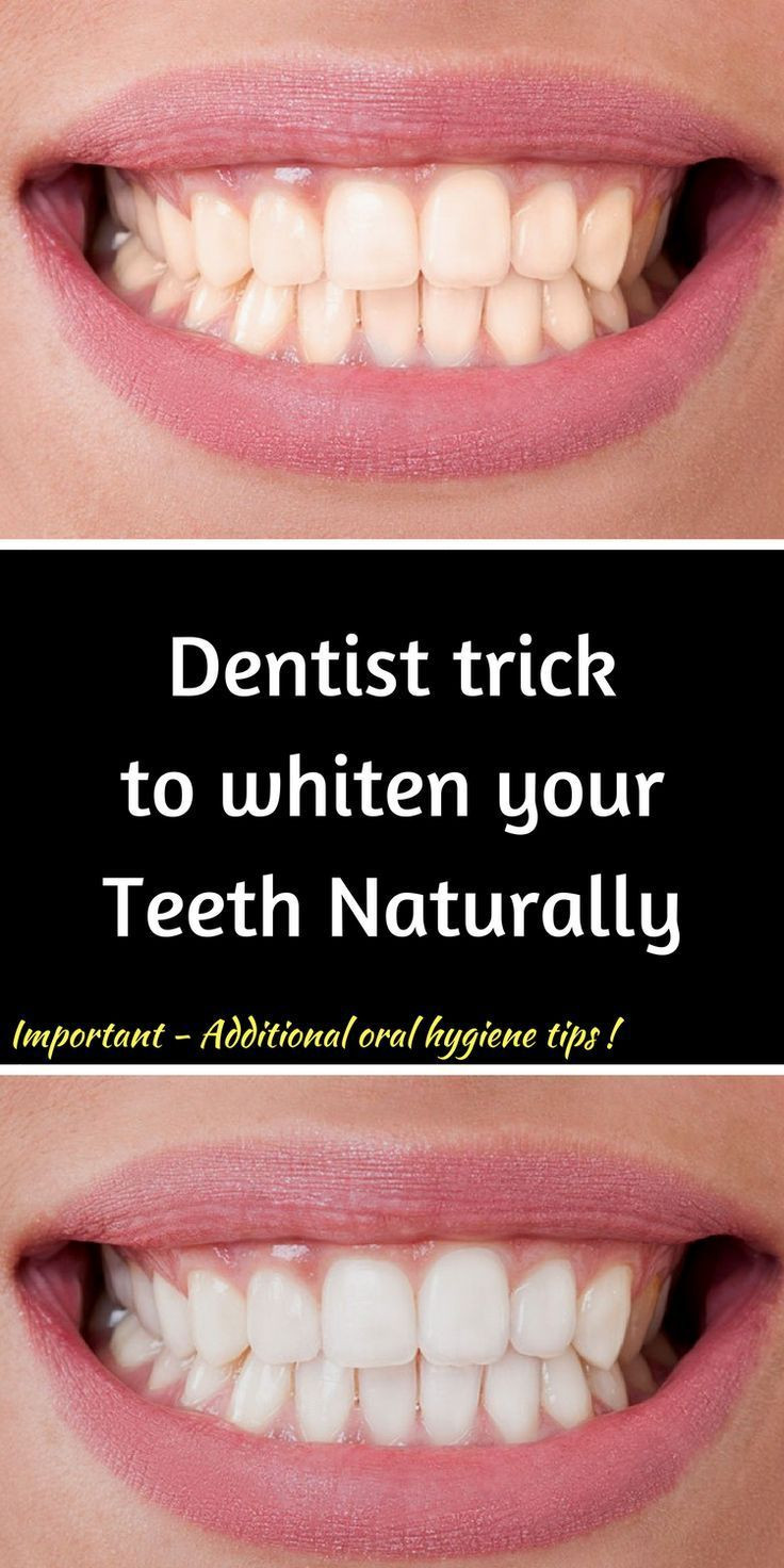 Best ideas about DIY Whiter Teeth
. Save or Pin Remove Plaque and Tartar and Whiten your Teeth with this Now.