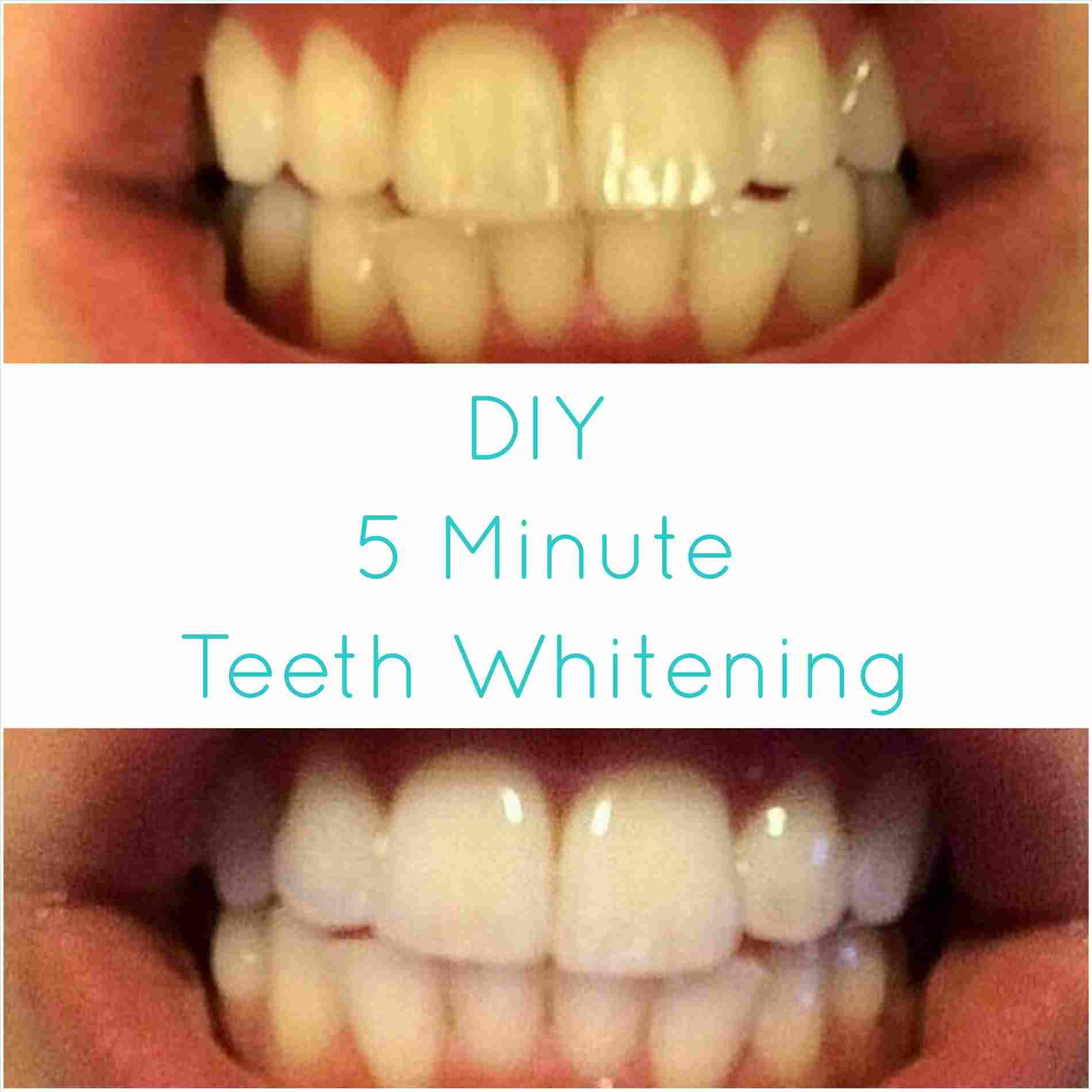 Best ideas about DIY Whiter Teeth
. Save or Pin diy for teeth whitening Now.