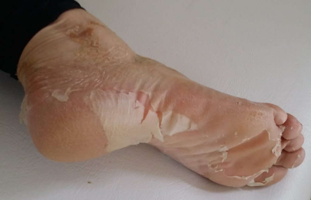 Best ideas about Foot Peel DIY
. Save or Pin Dry Cracked Heels This DIY Foot Peel Home Kit is Brilliant Now.